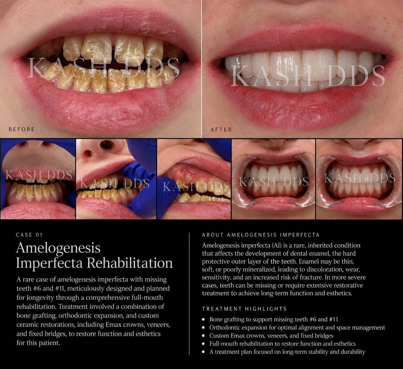 Watermarked before and after dental rehabilitation