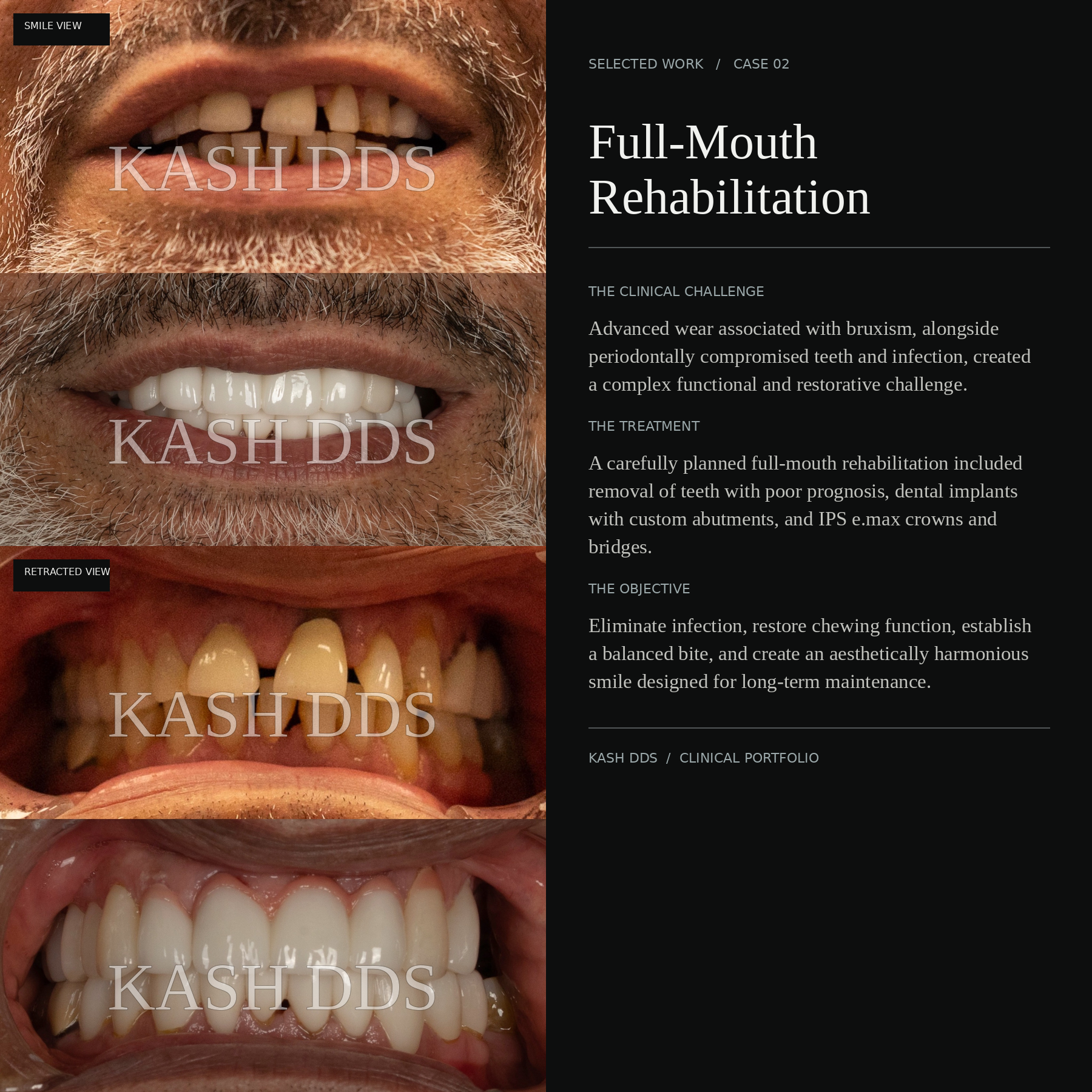 KASH DDS watermarked Case 02 before-and-after photographs and treatment narrative